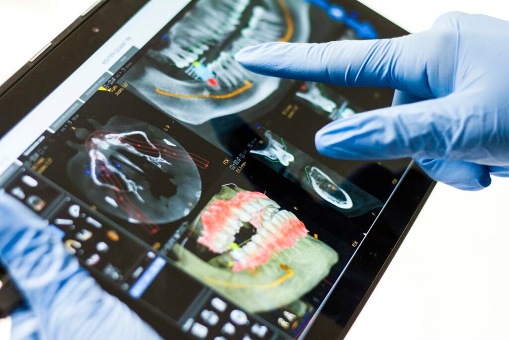 Gloved hand reviewing a 3D dental scan of a jaw on a tablet